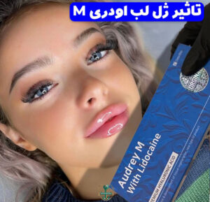 خرید ژل اودری اصل