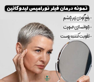 قیمت ژل نورامیس لیدوکائین