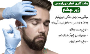 خرید ژل نورامیس لایت