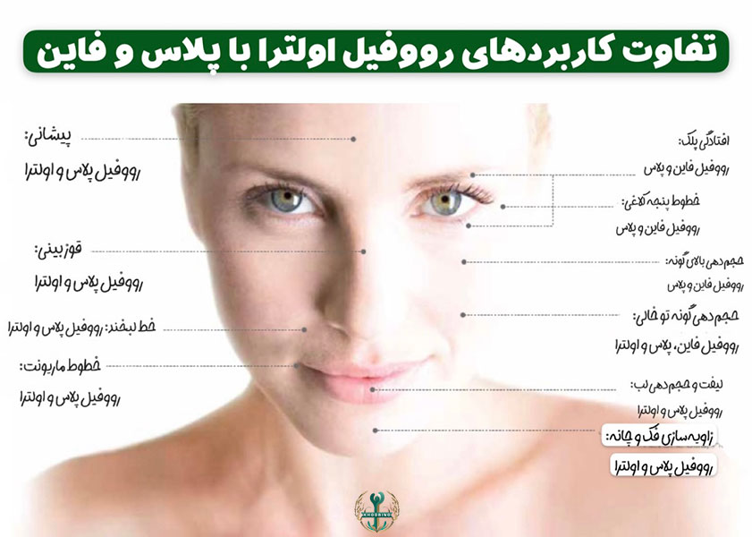 قیمت فیلر Revofil Ultra