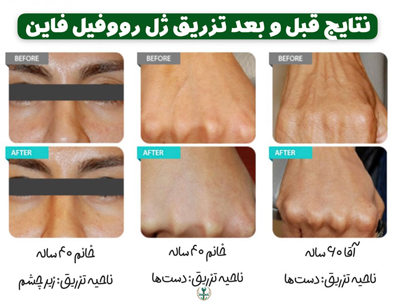 قیمت Revofil Fine