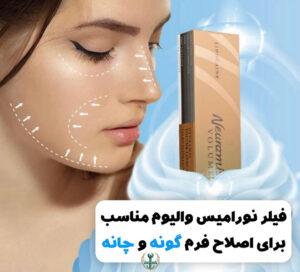 قیمت ژل نورامیس طلایی