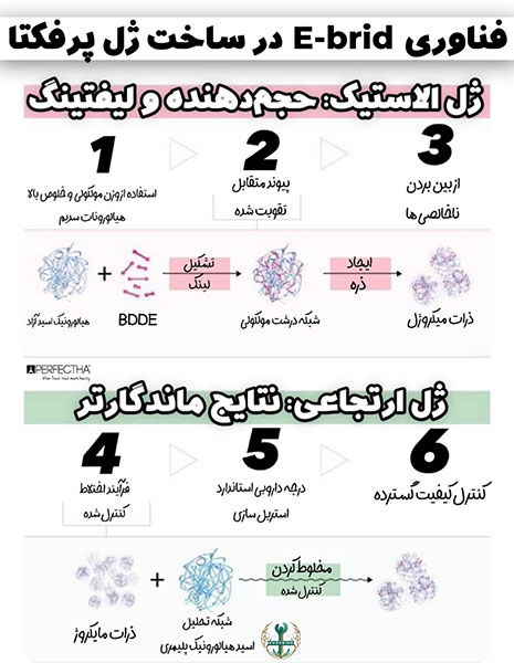 هزینه تزریق ژل پرفکتا