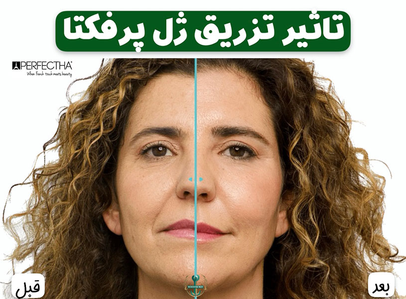 پرفکتا قیمت